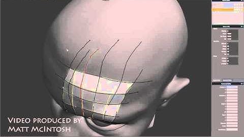 Retopping Technique 01