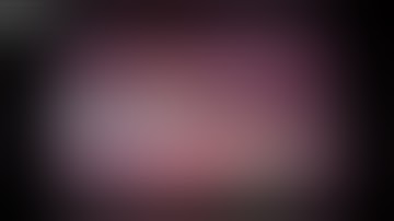 Lap. Vagas- Preserving Proximal Gastrectomy en-bloc with splenectomy for locally advanced GIST