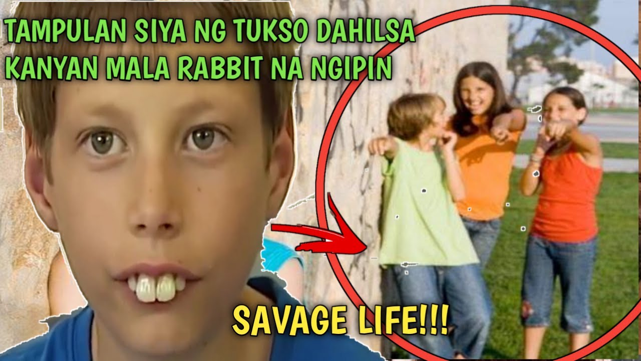 PINAGTATAWANAN SIYA DAHIL SA MALA RABBIT NYANG NGIPIN, MAKALIPAS ANG ...