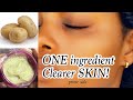 GET A CLEARER SKIN WITH ONE INGREDIENT | CLEAR DARK KNUCKLES | POTATO SERUM | PRIME SIDE