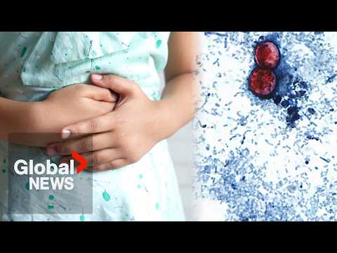Rapidly spreading diarrhea-causing illness results in 2 deaths in Michigan