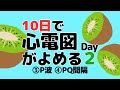 【10日で心電図がよめる】2日目 ③P波 ④PQ間隔