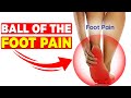 Ball of the Foot Pain &amp; Metatarsalgia Home Remedy [Metatarsal Pads]