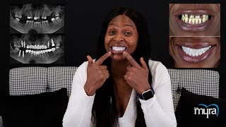 Amazing Smile Makeover 2021 [Full Mouth Dental Implants | Veneers]