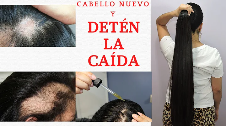 COMO DETENER LA CAIDA DEL PELO Y LOGRAR QUE TE NAZ...