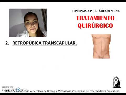 hiperplasia prostatica benigna tratamiento quirurgico)