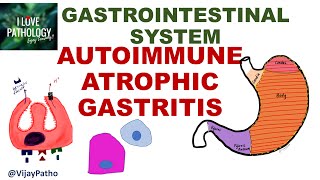 AUTOIMMUNE ATROPHIC GASTRITIS: Pathogenesis, clinical features, morphology & prognosis