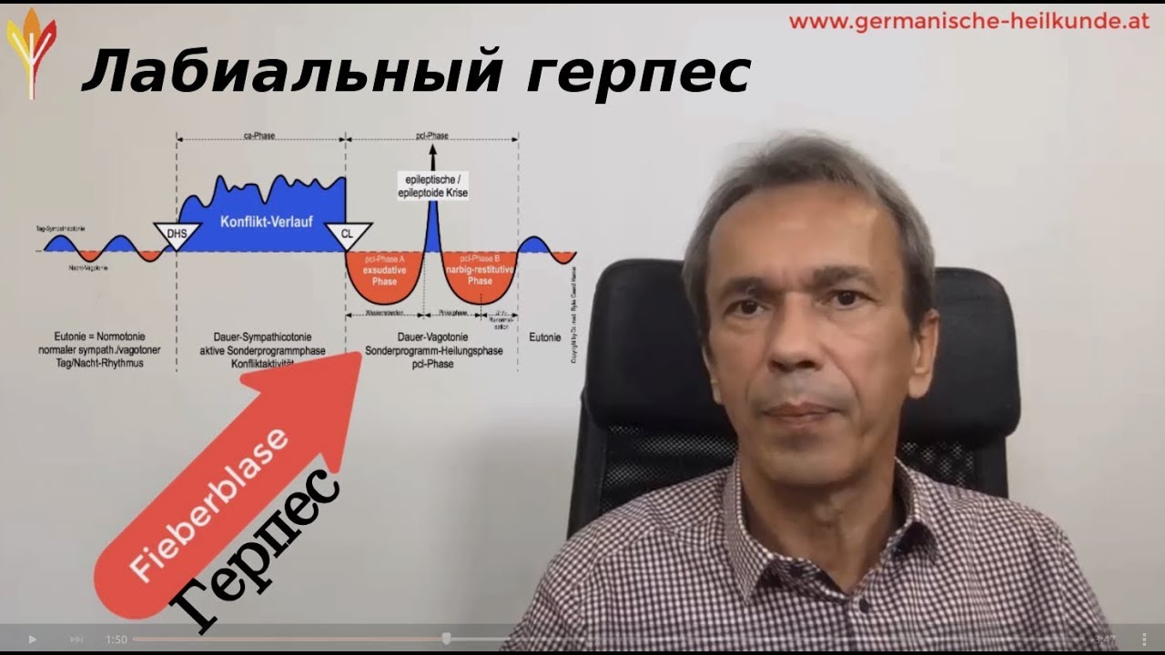 Лабиальный герпес