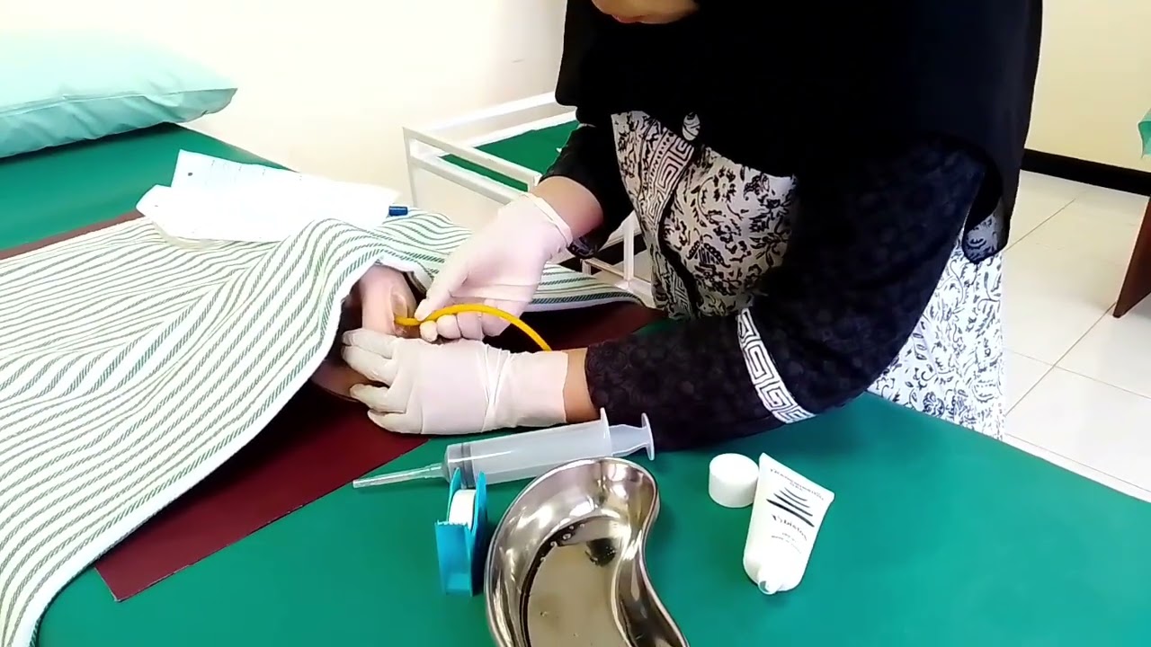 Pemasangan Kateter Sebelum pemberian Mgso4 