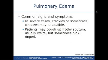 Respiratory Emergencies Lecture 5 / EMT MADE EASY