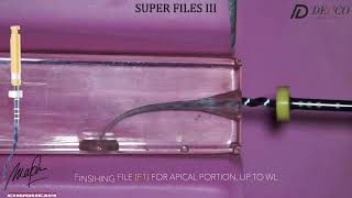 Denco Super Files III