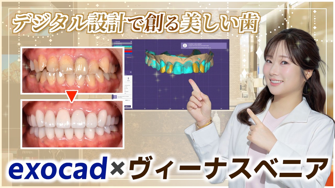 最新デジタル技術で「理想の白さ」を実現！精密な自社オリジナル「韓国