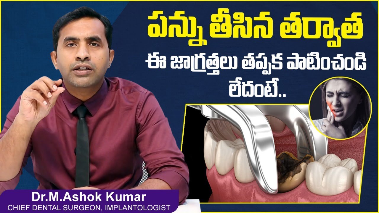 పన్ను తీసిన తర్వాత| Dos And Don'ts After Tooth Extraction | Tooth Removal | Eledent Dental Hospitals