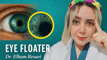 Eye Floaters Explained: Causes, Treatment & When to Worry | Dr. Elham Rezaei