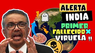 ALERTA  ⚠️ MORTALIDAD POR VIRUELA AUMENTA - INDIA REGISTRA PRIMER FALLECIDO