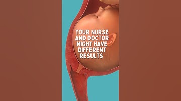 Cervix Exam in Labor and Delivery # birth