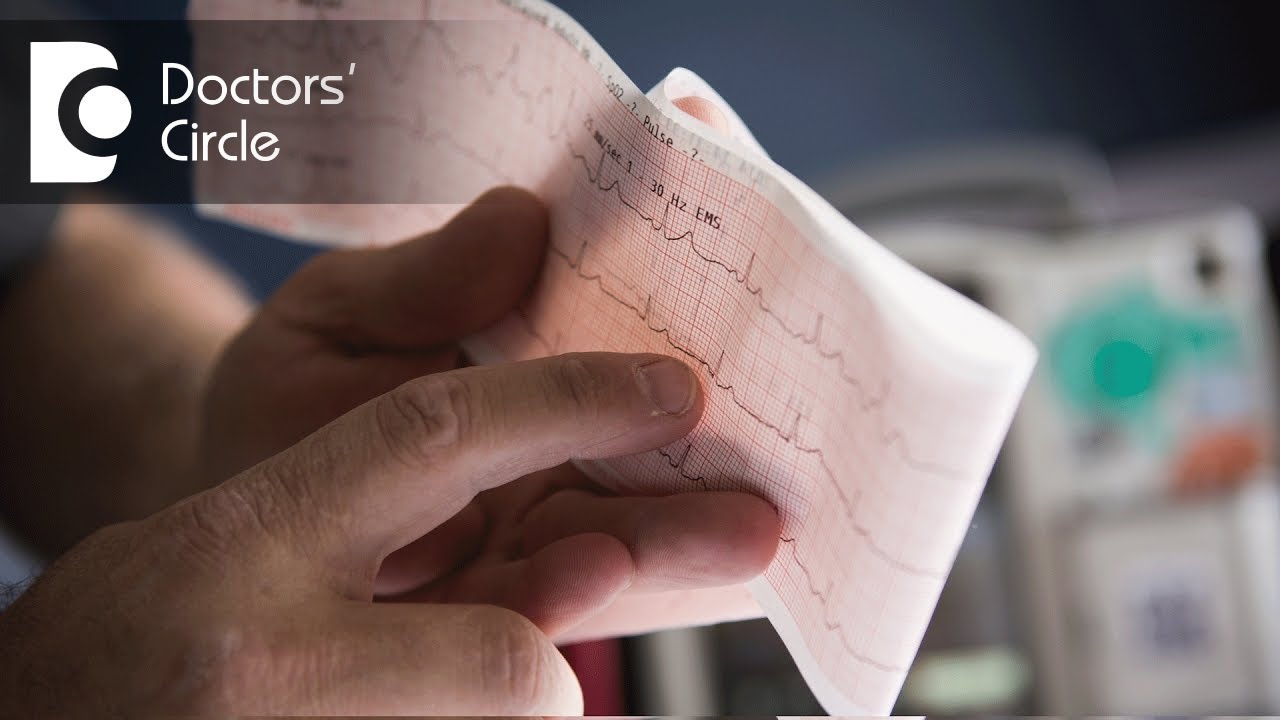 Emergency treatment for heart attack Dr. Ramesh Basavanna YouTube