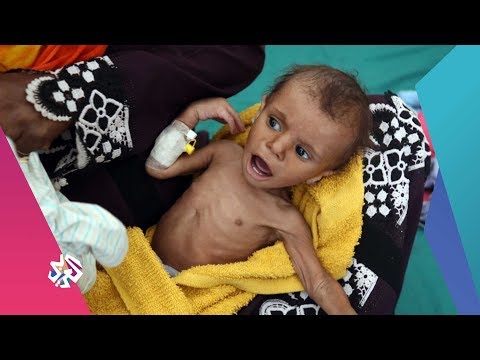 العربي اليوم الفقر يدفع أهالي منطقة حجة اليمنية إلى أكل أوراق الشجر 