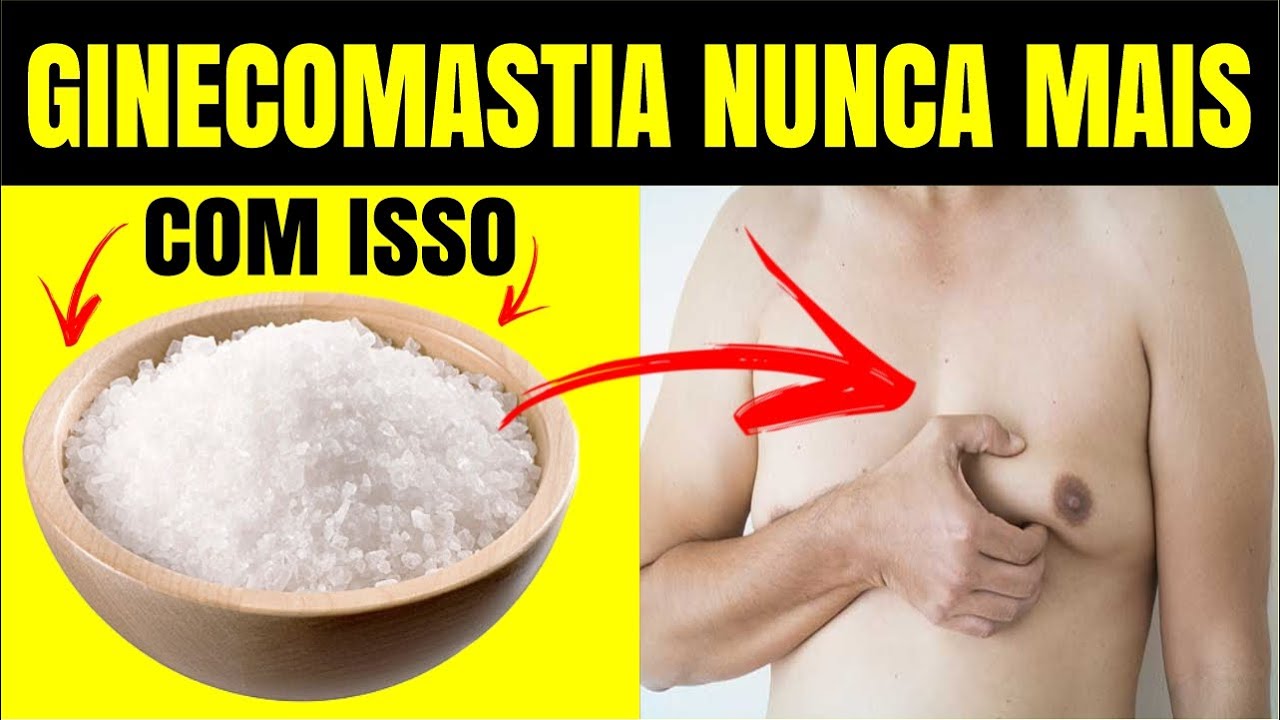 Como diminuir a ginecomastia - MÉTODO ÚNICO! Como eliminar ginecomastia ...