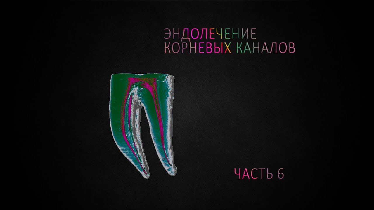 Корневые каналы под микроскопом Лечение зубов под микроскопом