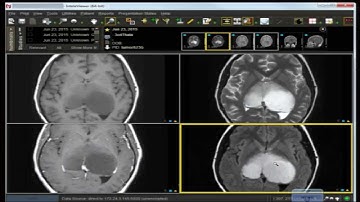 Neuro Imaging: Board and Recredentialing Review 3