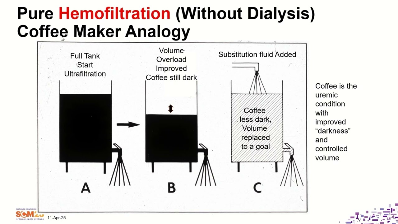 2025 Spring Clinical Meetings — Hemodialfiltration HDF Are We Ready for it and How is it Different