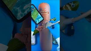 Thumbnail for Emergency #FruitSurgery! Glizzy stuck inside! 😩😰#DiscountDentist #FruitSurgery #FoodSurgery #ASMR