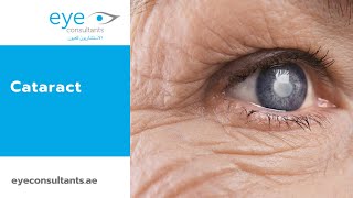 Cataract - Causes - Symptoms Treatment Guideline By Dr. Ahmed El Khashab