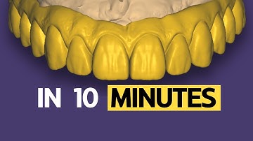 NEW Technique To Save Hours All on X. Tutorial (In Detail) EXOCAD