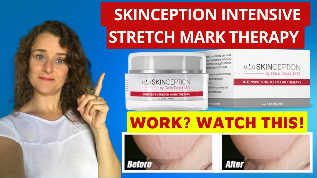 Skinception Intensive Stretch Mark Therapy [REVIEW] Discover The Power Of This Product!