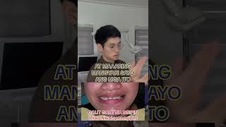 Gusto mo ba mag fake braces?