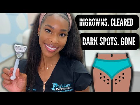 HOW TO GET THE PERFECT BIKINI LINE! No more dark spots, Ingrown hairs or bumps!