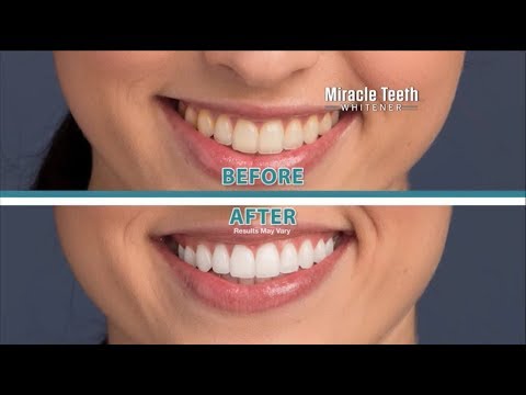 Temp Tooth TV Commercials 