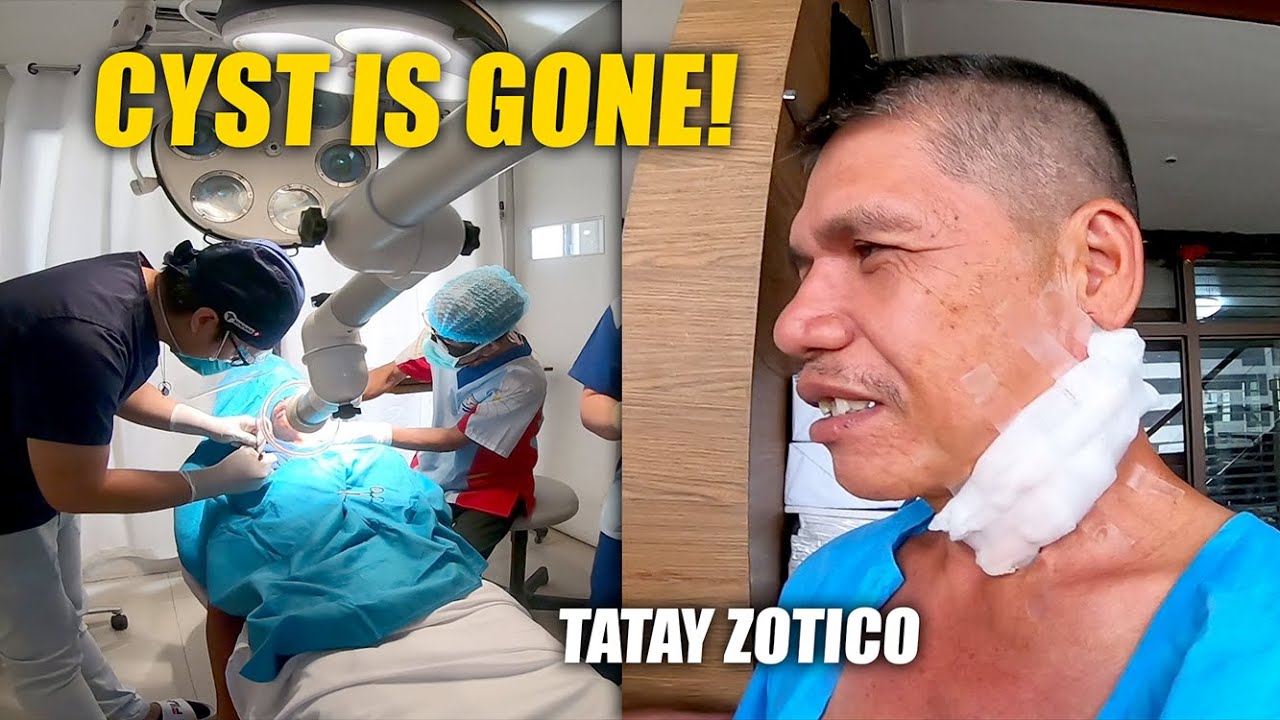 Bukol Sa Leeg Na Masakit SURGERY DAY NI TATAY ZOTICO! (Wala na ang malaking bukol sa leeg