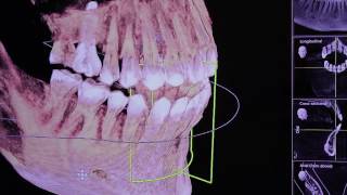 Aadvanced Dentistry Northwest Dallas (Kwon Dental)