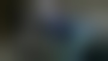 Neuroarm Robot Performs in Neurosurgery