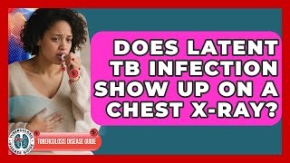 Does Latent TB Infection Show Up on a Chest X-Ray? | Tuberculosis Disease Guide News