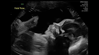 Myra And Hectors Baby Shower For Mateo 02.21.26