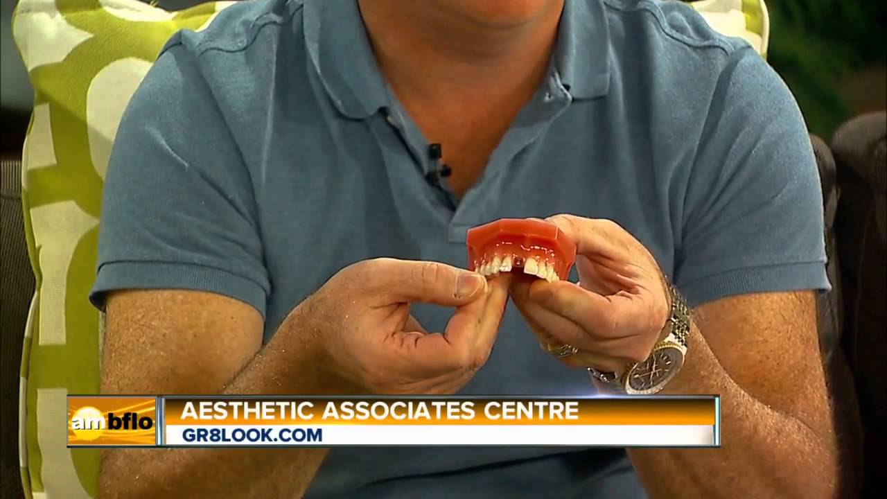 Buffalo Dental Implants Todd E. Shatkin, DDS 7168391700 YouTube