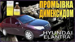 Промывка двигателя G4FC Димексидом (Hyundai Elantra 4 поколение)