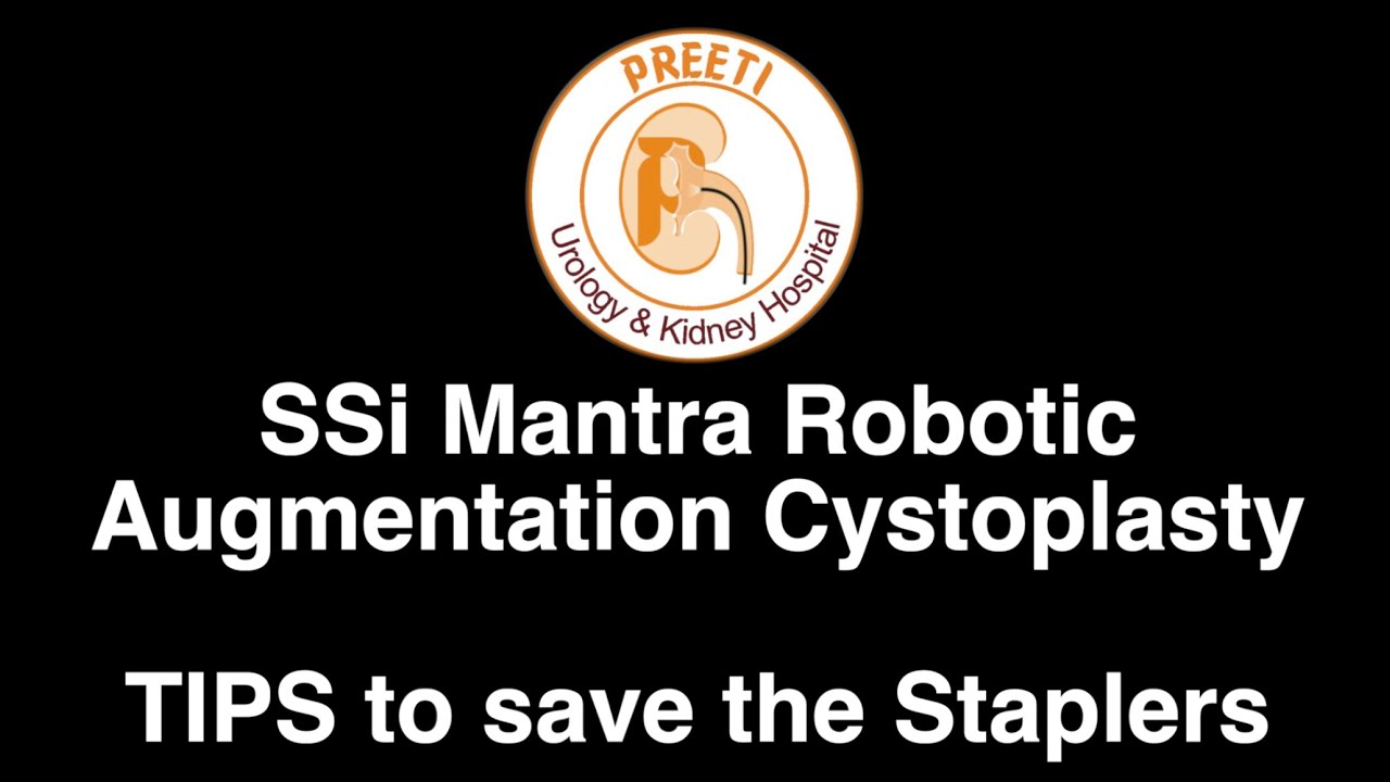 SSi Mantra Robotic Augmentation Cystoplasty - TIPS to save the Staplers