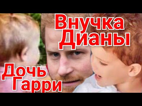 Video: Принц Гарри чач трансплантациялоо клиникасында байкалды