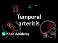 Temporal arteritis | Circulatory System and Disease | NCLEX-RN | Khan Academy
