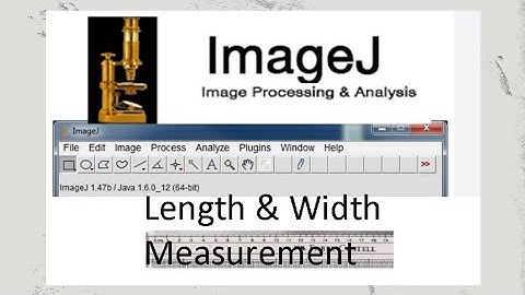 Image J length and width measurement tool