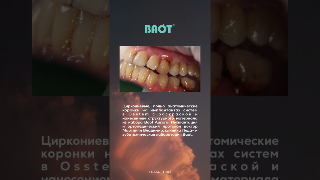 Для заказа керамической массы BAOT:💻 Интернет-магазин russalmed.ru✅ Whatsapp +7-995-119-26-28