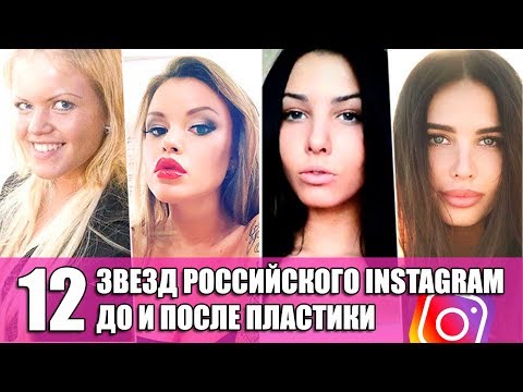 Звезды Российского инстаграм до и после пластики top Instagram russian stars