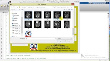 Matlab Code for Types of Brain Tumor Detection and Classification Full Project Code