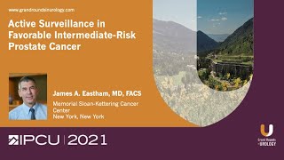 Active Surveillance in Favorable IntermediateRisk Prostate Cancer