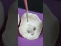 Satisfying Root Canal And Crown Process Shorts Satisfying Root Canal And Crown Process Shorts