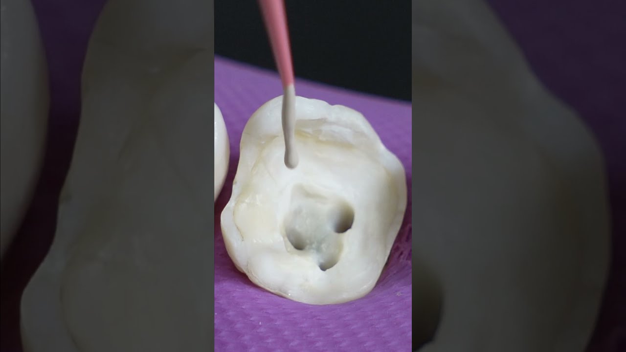 Satisfying Root Canal And Crown Process Shorts